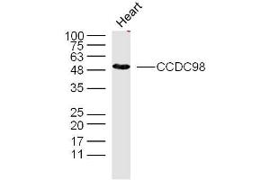 Mouse heart lysates probed with CCDC98 Polyclonal Antibody, unconjugated  at 1:300 overnight at 4°C followed by a conjugated secondary antibody at 1:10000 for 90 minutes at 37°C. (CCDC98 抗体  (AA 51-150))