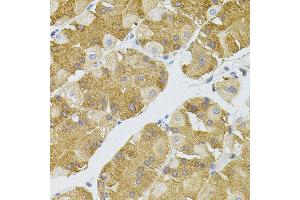 Immunohistochemistry of paraffin-embedded human stomach using NAT8 antibody. (NAT8 抗体)