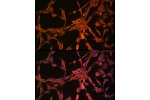 Immunofluorescence (IF) image for anti-Thymidine Kinase 1, Soluble (TK1) (AA 1-234) antibody (ABIN6149198)