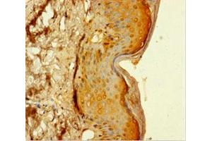 Immunohistochemistry of paraffin-embedded human skin tissue using ABIN7159033 at dilution of 1:100 (MAML1 抗体  (AA 1-45))