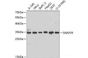 Western blot analysis of extracts of various cell lines using SNAP29 Polyclonal Antibody at dilution of 1:1000. (SNAP29 抗体)