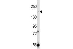 Western Blotting (WB) image for anti-Transient Receptor Potential Cation Channel, Subfamily M, Member 7 (TRPM7) (AA 1821-1850) antibody (ABIN3029239)