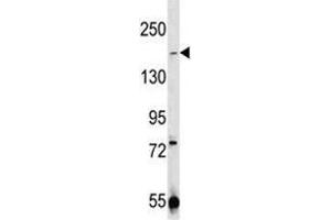 TRPM7 antibody western blot analysis in 293 lysate (TRPM7 抗体  (AA 1821-1850))