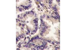 Immunohistochemistry (IHC) image for anti-Vascular Endothelial Growth Factor C (VEGFC) antibody (ABIN3001426)