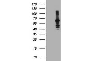 Western Blotting (WB) image for anti-Dystrobrevin, beta (DTNB) antibody (ABIN1497913) (Dystrobrevin beta 抗体)