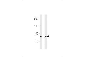 Western Blotting (WB) image for anti-Sema Domain, Transmembrane Domain (TM), and Cytoplasmic Domain, (Semaphorin) 6B (SEMA6B) (AA 830-859), (C-Term) antibody (ABIN1881786)