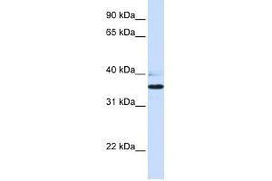 B3GALT1 antibody used at 1 ug/ml to detect target protein.