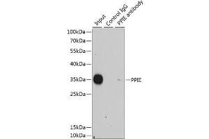 Immunoprecipitation analysis of 200 μg extracts of HeLa cells using 1 μg PPIE antibody . (PPIE 抗体  (AA 1-301))