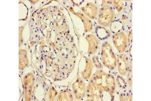 Immunohistochemistry of paraffin-embedded human kidney tissue using ABIN7161762 at dilution of 1:100 (NFIX 抗体  (AA 201-440))