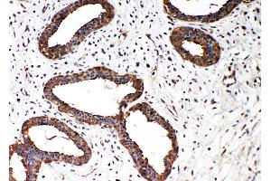 Immunohistochemistry (IHC) image for anti-SMAD, Mothers Against DPP Homolog 2 (SMAD2) (AA 94-112), (N-Term) antibody (ABIN3044112)