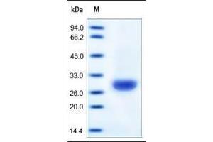 SDS-PAGE (SDS) image for Carbonic Anhydrase II (CA2) (AA 1-260) protein (His tag) (ABIN2180674)