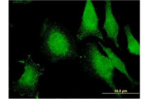 Immunofluorescence of monoclonal antibody to FIBP on HeLa cell. (FIBP 抗体  (AA 1-357))