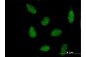 Immunofluorescence (IF) image for anti-Nuclear Receptor Subfamily 1, Group H, Member 3 (NR1H3) (AA 1-402) antibody (ABIN523438)