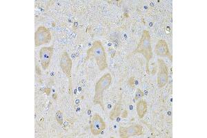 Immunohistochemistry of paraffin-embedded mouse brain using EPHA2 Antibody (ABIN2562444) at dilution of 1:100 (40x lens). (EPH Receptor A2 抗体)