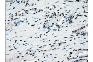 Image no. 17 for anti-P450 (Cytochrome) Oxidoreductase (POR) antibody (ABIN1497746) (POR 抗体)