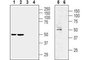Western blot analysis of rat brain membrane (lane 1 and 3), mouse brain membrane (lanes 2 and 4) and human brain glioblastoma U87 MG cell line (lanes 5 and 6) lysate:  - 1,2,5. (LPAR1 抗体  (Extracellular, N-Term))