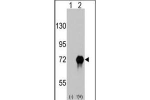 Western blot analysis of RAF1 (arrow) using rabbit polyclonal RAF1 Antibody  (ABIN6243077 and ABIN6579013). (RAF1 抗体  (AA 599-628))