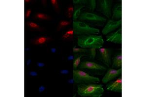 ABIN6264926 and ABIN6279887 staining  cells by IF/ICC. (SART1 抗体  (C-Term))