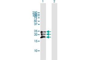 Western Blot analysis of BST2 expression in transfected 293T cell line by BST2 MaxPab polyclonal antibody. (BST2 抗体  (AA 1-180))