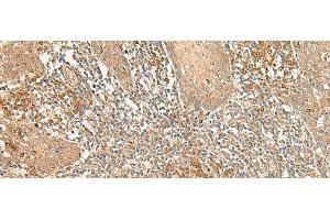 Immunohistochemistry of paraffin-embedded Human tonsil tissue using WLS Polyclonal Antibody at dilution of 1:50(x200) (GPR177/WLS 抗体)