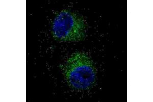Immunofluorescence (IF) image for anti-Met Proto-Oncogene (MET) antibody (ABIN2995276) (c-MET 抗体)