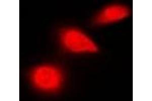 Immunofluorescent analysis of p53 staining in HeLa cells. (p53 抗体  (C-Term))