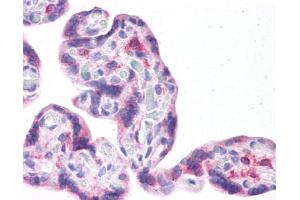 Immunohistochemistry (IHC) image for anti-Leucine Rich Repeat Containing 59 (LRRC59) (Middle Region) antibody (ABIN2783712) (LRRC59 抗体  (Middle Region))