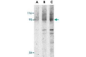 Western blot analysis of NOD2 in Jurkat cell lysate with NOD2 polyclonal antibody  at (A) 1, (B) 2 and (C) 4 ug/mL .