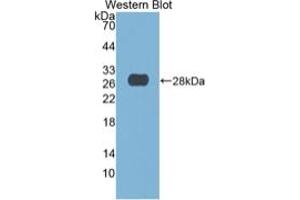 WB of Protein Standard: different control antibodies against Highly purified E.