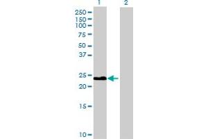 Western Blot analysis of CLEC2B expression in transfected 293T cell line by CLEC2B MaxPab polyclonal antibody. (CLEC2B 抗体  (AA 1-149))
