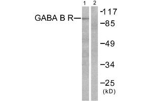 Western Blotting (WB) image for anti-GABA B Receptor (C-Term) antibody (ABIN1848554) (GABA B Receptor (C-Term) 抗体)