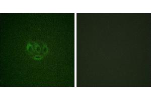 Immunofluorescence analysis of A549 cells, using ACK1 (Phospho-Tyr284) antibody. (TNK2 抗体  (pTyr284))