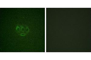 Immunofluorescence analysis of A549 cells, using ACK1 (Phospho-Tyr284) antibody. (TNK2 抗体  (pTyr284))