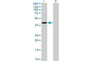 Western Blot analysis of TMOD2 expression in transfected 293T cell line by TMOD2 MaxPab polyclonal antibody. (TMOD2 抗体  (AA 1-351))