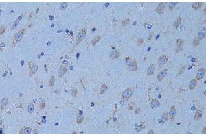Immunohistochemistry of paraffin-embedded Mouse brain using HADH Polyclonal Antibody at dilution of 1:100 (40x lens). (HADH 抗体)