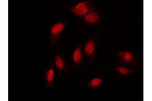 ABIN6267396 staining K562 by IF/ICC. (GATA1 抗体  (pSer310))