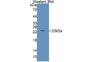 Western Blotting (WB) image for anti-ATP-Binding Cassette, Sub-Family A (ABC1), Member 9 (ABCA9) (AA 1416-1583) antibody (ABIN5013177)
