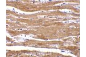 Immunohistochemistry of BACE2 in mouse heart with BACE2 antibody at 10 μg/ml. (BACE2 抗体  (N-Term))