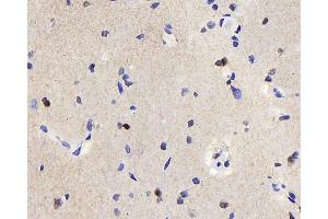 Immunohistochemistry analysis of paraffin-embedded rat brain using TSC22D3 Polyclonal Antibody at dilution of 1:300. (TSC22D3 抗体)
