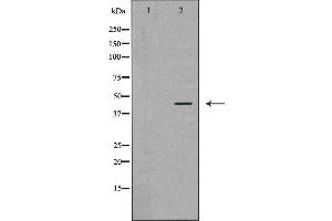 Western blot analysis of MCF-7  lysate using ATXN3 antibody. (Ataxin 3 抗体  (Internal Region))
