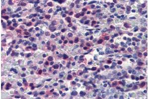 Human Spleen (formalin-fixed, paraffin-embedded) stained with CASP7 antibody ABIN462357 followed by biotinylated anti-mouse IgG secondary antibody ABIN481714, alkaline phosphatase-streptavidin and chromogen. (Caspase 7 抗体)