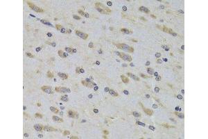 Immunohistochemistry of paraffin-embedded Rat brain using RPL3 Polyclonal Antibody at dilution of 1:100 (40x lens). (RPL3 抗体)