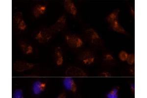 Immunofluorescence analysis of U-2 OS cells using SEC14L2 Polyclonal Antibody at dilution of 1:100 (40x lens). (SEC14L2 抗体)