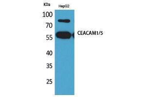 Western Blotting (WB) image for anti-Carcinoembryonic Antigen-Related Cell Adhesion Molecule 1/5 (CEACAM1/5) (N-Term) antibody (ABIN3178236) (CEACAM1/5 抗体  (N-Term))