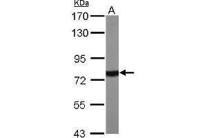 Western Blotting (WB) image for anti-Heat Shock 70kDa Protein 1A (HSPA1A) (Center) antibody (ABIN2856787)