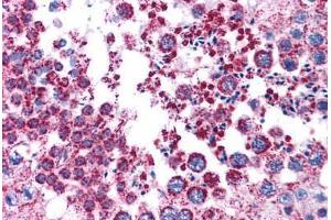 Human Testis: Formalin-Fixed, Paraffin-Embedded (FFPE) (MAGEA3 抗体  (AA 216-265))