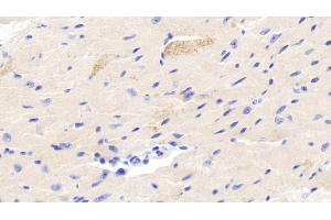 Immunohistochemistry (IHC) image for anti-Follistatin-Like 3 (Secreted Glycoprotein) (FSTL3) (AA 24-256) antibody (ABIN7436606)
