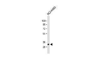 All lanes : Anti-VDAC3 Antibody (Center) at 1:1000 dilution Lane 1: Human heart lysate Lane 2: NCI- whole cell lysate Lane 3: A431 whole cell lysate Lane 4: U-2OS whole cell lysate Lane 5: Mouse testis lysate Lane 6: Rat brain lysate Lysates/proteins at 20 μg per lane. (VDAC3 抗体  (AA 156-183))