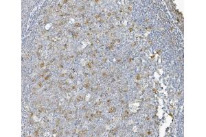 IHC analysis of CCNB1 using anti-CCNB1 antibody (ABIN7599335).
