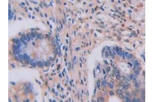 Immunohistochemistry (IHC) image for anti-Lysyl Oxidase-Like 2 (LOXL2) (AA 544-751) antibody (ABIN7438565)